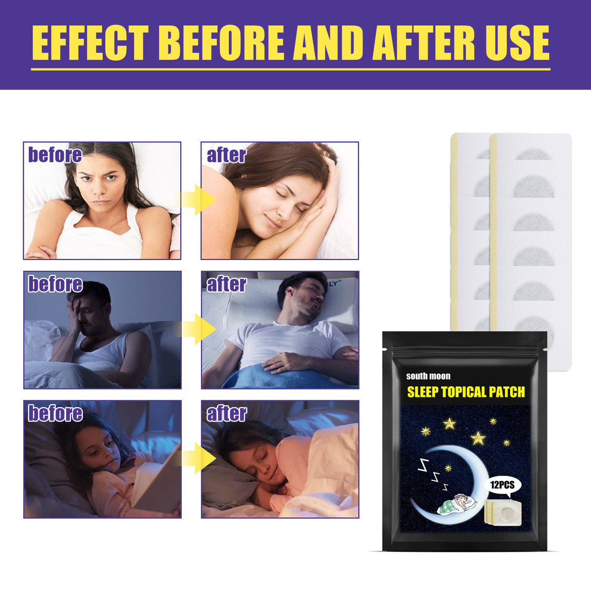 Menthol & Acanthopanax Temple Patches - 12 Pack